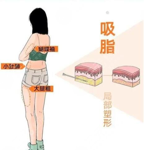 關于減肥的好方法具體有哪些？四種方法輕松見慢、四種方法見快！