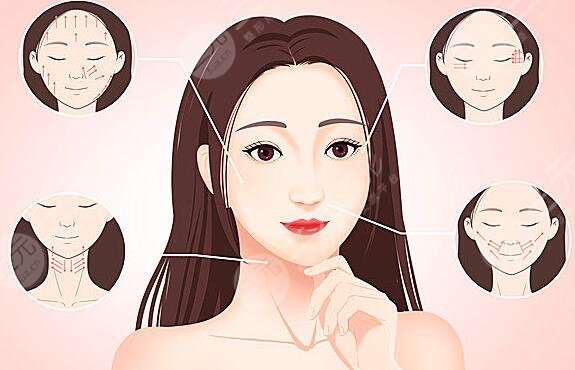 怎么樣去掉抬頭紋?