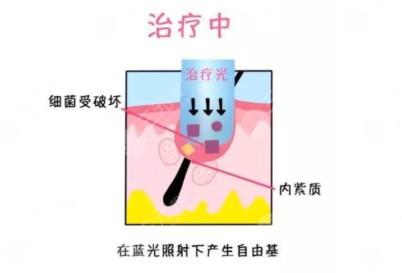 維a