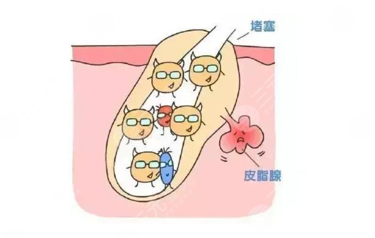 維a