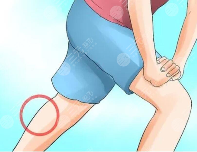 小腿吸脂手術(shù)價格多少錢2023？手術(shù)注意事項說明，擁有漫畫版修長腿！