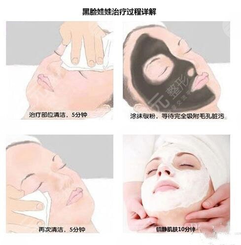 影響黑臉娃娃價(jià)格的因素