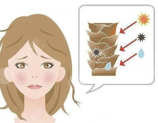 彩光嫩膚副作用大嗎?