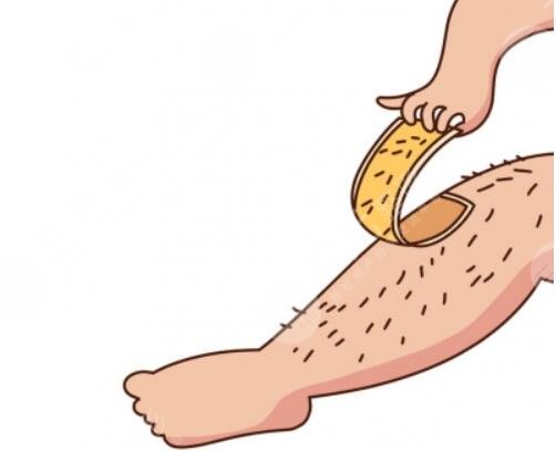 激光脫毛的原理是什么呢?