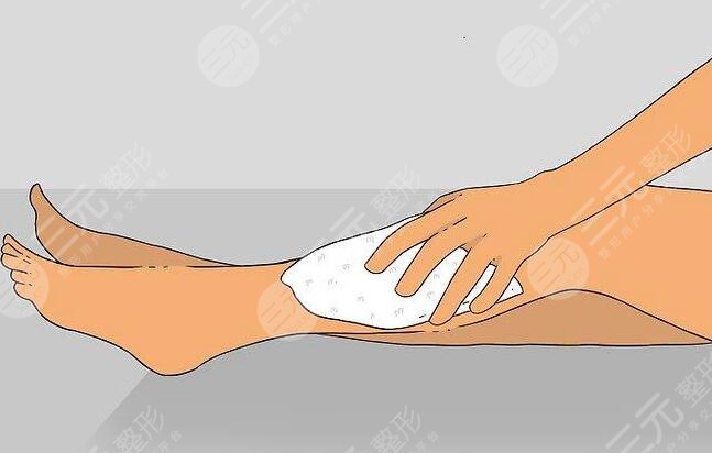 小腿激光脫毛的價格多少錢?