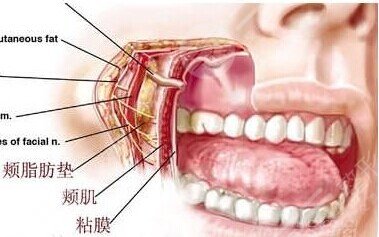 去頰脂墊的原理?是什么?