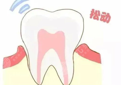 牙齒松動有什么辦法恢復(fù)?
