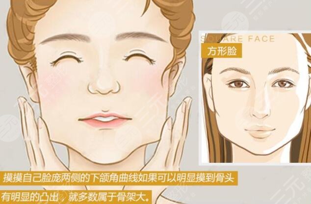 削骨瘦臉會有后遺癥嗎？