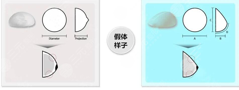 隆胸假體維持多長時間？