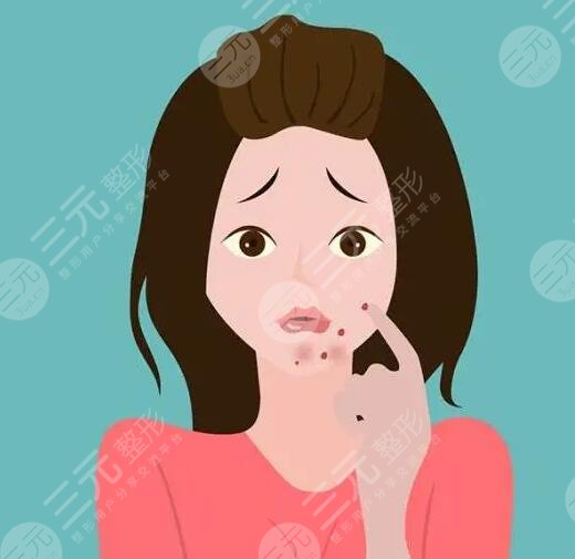 　　如何快速去青春痘?對于青春期的男生和女生們來講，大多數(shù)人都難逃青春痘的困擾，青春痘嚴(yán)重的時(shí)候會影響到一個(gè)人的顏值，所以青春期的男生和女生們大多都在戰(zhàn)“痘”，可是在緩解痘痘的時(shí)候也需要選對方法，不要盲目的去除痘痘，以免對皮膚造成傷害，下面做一個(gè)護(hù)膚達(dá)人，就來帶大家深入的認(rèn)識一下，如何快速去除青春痘?被青春痘困擾的男生女生可以詳細(xì)來了解一下。  　　1、如何快速去青春痘?  　　日常生活中快速去除青春痘的方式，常見的有藥物緩解、激光緩解以及紅藍(lán)光照射等，可以根據(jù)自己的皮膚狀態(tài)選擇適合自己的去除青春痘方式。  　　(1)藥物緩解  　　皮膚上的青春痘可以在專業(yè)醫(yī)生指導(dǎo)下，使用紅霉素軟膏或者阿達(dá)帕林凝膠進(jìn)行緩解，這些藥膏能夠快速消除青春痘。但是需要在專業(yè)醫(yī)生指導(dǎo)下規(guī)范用藥，不要盲目的使用，以免對皮膚造成傷害。  　　(2)激光緩解  　　激光緩解青春痘是醫(yī)療美容界的一種新型祛痘方式，激光緩解青春痘的原理，主要通過激光儀器所發(fā)出的高能熱量穿透皮膚表皮層，直接作用在皮膚基底層，這種熱量能夠促進(jìn)皮膚深層細(xì)胞組織生長，從而可以讓皮膚上的青春痘逐漸修復(fù)，可以讓皮膚恢復(fù)到光滑平整的目的。  　　(3)紅藍(lán)光照射  　　紅藍(lán)光照射緩解青春痘，主要采用專業(yè)儀器發(fā)出的紅光熱效應(yīng)和藍(lán)光熱效應(yīng)對皮膚進(jìn)行交替照射，緩解皮膚上青春痘的同時(shí)還可以消除皮膚上的炎癥，是緩解青春痘的一種不錯(cuò)的方式。  　　2、青春痘是怎樣形成的?  　　青春痘大多是因?yàn)槊移ぶ傺装Y性病變導(dǎo)致的，因?yàn)樯眢w的內(nèi)分泌失調(diào)，導(dǎo)致雄激素水平偏高，從而誘發(fā)皮脂腺分泌增多，同時(shí)毛孔角化排出也不夠順暢，從而就形成了脂肪酸，繼發(fā)細(xì)菌感染的時(shí)候就會形成青春痘。另外在日常生活中長時(shí)間喝酒，或者總是吃一些高脂肪飲食，或者是日常生活中總是長時(shí)間熬夜也會導(dǎo)致青春痘生長。需要注意的是青春痘并不一定是發(fā)生在青春期的，通?，F(xiàn)在大多數(shù)人因?yàn)樯罟?jié)奏加快，成年人長青春痘也不少見，并且比青春期長的青春痘要比較頑固和復(fù)雜。  　　3、怎樣防止青春痘?  　　想要防止青春痘，在日常生活中要養(yǎng)成良好的飲食習(xí)慣和規(guī)律作息，平時(shí)飲食盡量少吃吃熱量比較高和脂肪含量比較高的食物，飲食可以以清淡食物為主，可以適當(dāng)?shù)亩喑砸恍┬迈r的蔬菜和水果，多喝一些溫開水，補(bǔ)充身體所需要的維生素和微量元素，防止身體便秘。另外還要適當(dāng)?shù)募訌?qiáng)體育運(yùn)動，讓身體適當(dāng)?shù)亩喑鲆恍┖?。除此之外要養(yǎng)成良好的規(guī)律作息，每天保持充足的睡眠，不要長時(shí)間熬夜，避免有太大的精神壓力和過于抑郁的情緒。