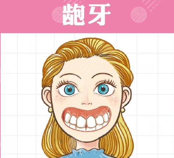 深覆合矯正要多久？