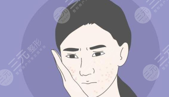 面部皮膚干燥粗糙