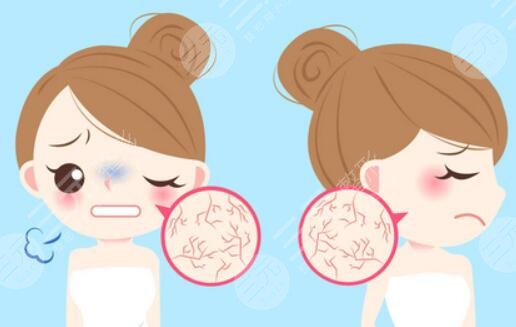 面部皮膚干燥粗糙