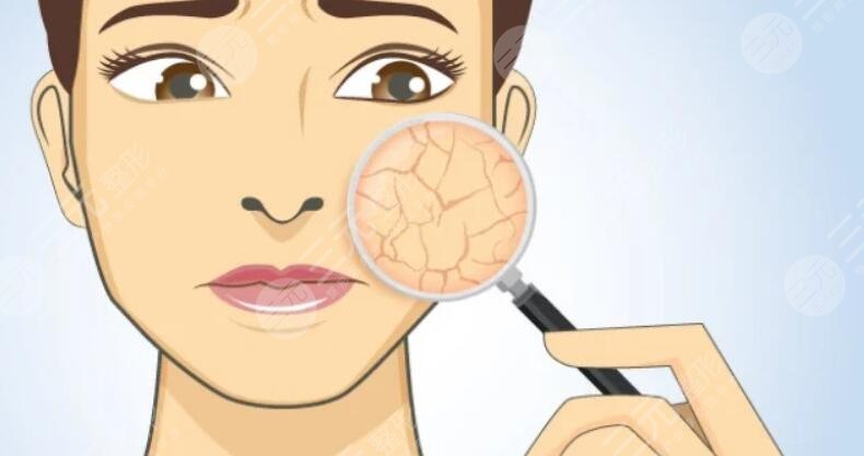 面部皮膚干燥粗糙