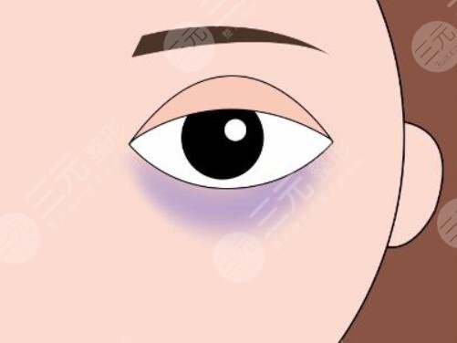 有黑眼圈是怎么回事？先天遺傳、后天因素導(dǎo)致的原因分析，該怎么有效避免？