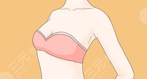 乳房提升棒棒糖手術多少錢2023同步！手術原理及效果怎么樣？專家告訴你實情~