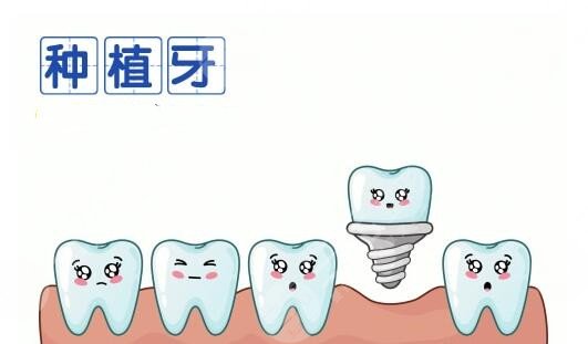 種植牙齒多少錢？