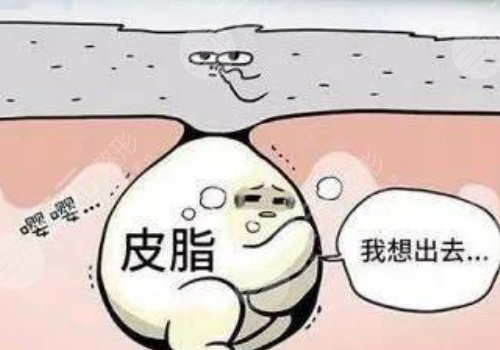 眼周圍有脂肪粒怎么引起的？