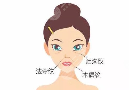 法令紋太深了有什么解決辦法？