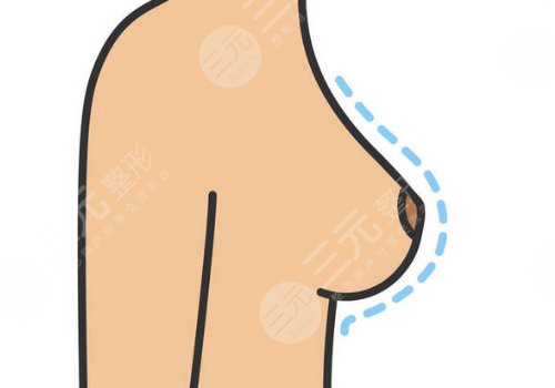 奧美定取出手術(shù)后要注意些什么？