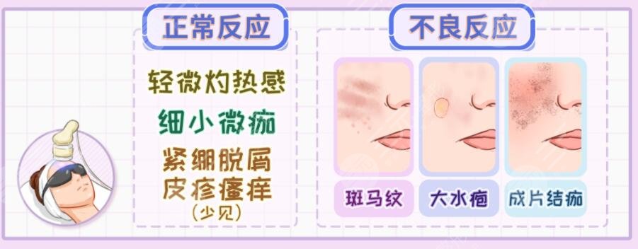 鐳射激光嫩膚原理