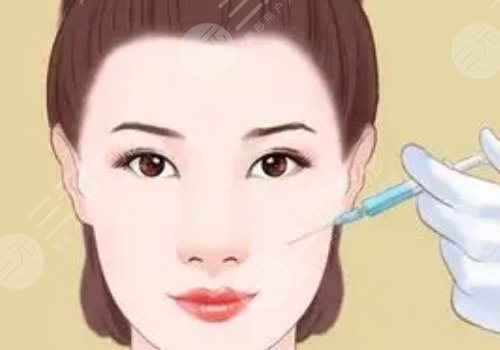 注射寶尼達(dá)玻尿酸多長(zhǎng)時(shí)間可以洗臉？
