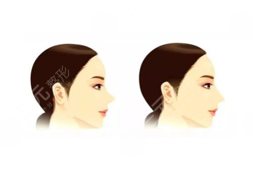 李愛林做鼻子怎么樣?