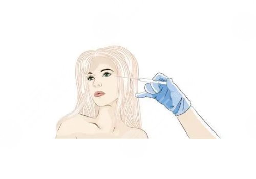 婕爾玻尿酸可以打哪些部位？