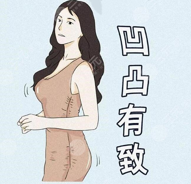 傲諾拉璀璨水滴假體型號(hào)分類，不同型號(hào)有什么區(qū)別？上榜指數(shù)五顆星~