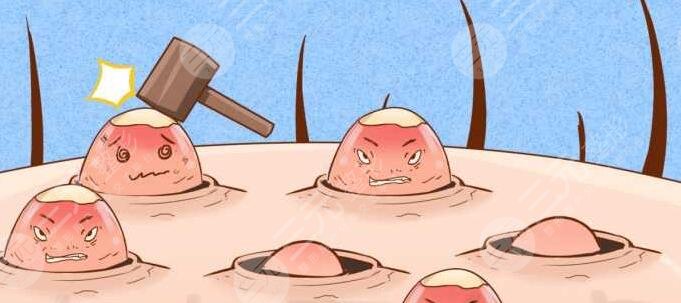 快速祛痘小竅門有哪些？外防內(nèi)治讓效果更徹底！找對長痘根源才是關(guān)鍵！