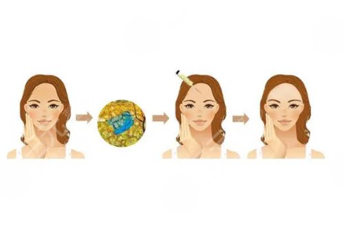 林曉曦醫(yī)生預(yù)約掛號(hào)指南