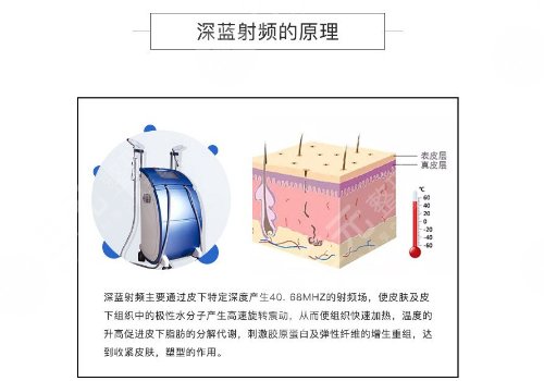 深藍(lán)射頻做一次有效果嗎？