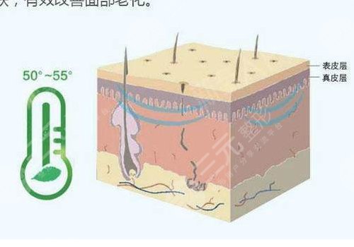 深藍(lán)射頻做一次有效果嗎？