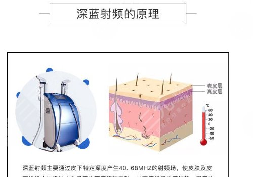 深藍(lán)射頻和熱拉提哪個(gè)好？