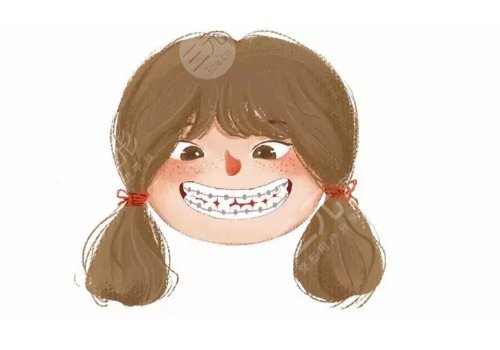 牙齒矯正用隱形牙套還是鋼絲牙套好？