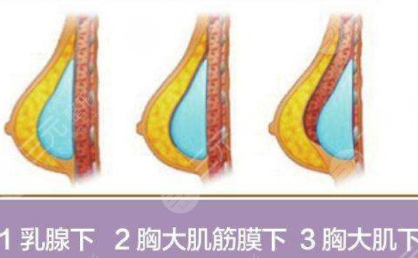 北京八大處醫(yī)院王連召醫(yī)生怎么樣？