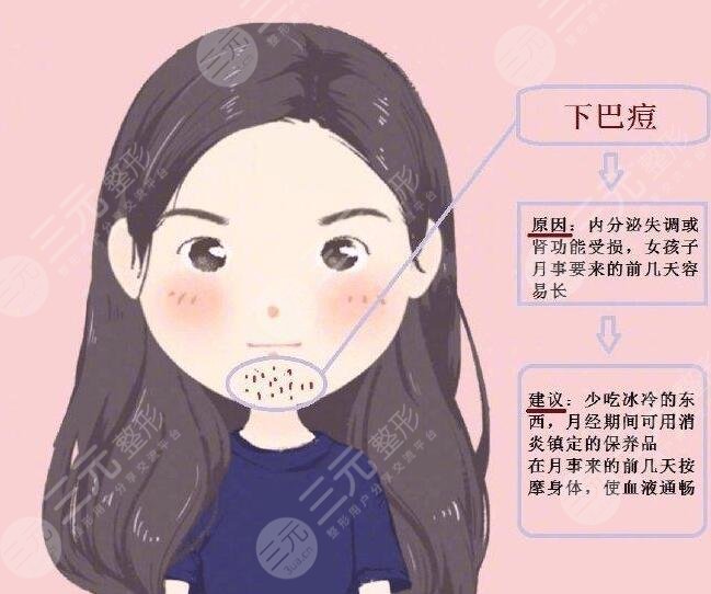內(nèi)分泌失調(diào)