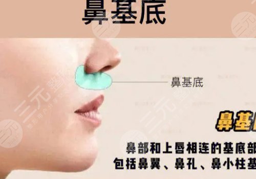 鼻基底注射玻尿酸會(huì)移位嗎？