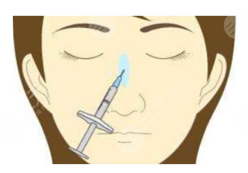 打玻尿酸隆鼻子有副作用嗎？
