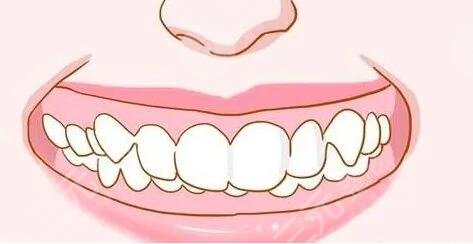 22歲還能矯正牙齒么有用么?