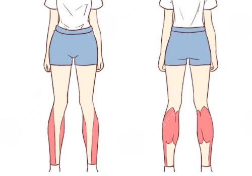 小腿吸脂后多久可以正常走路？
