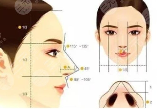 隆鼻假體取出來后能恢復到以前嗎？