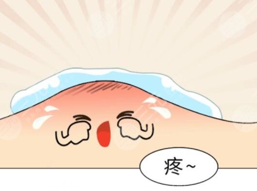 激光祛痘適用人群