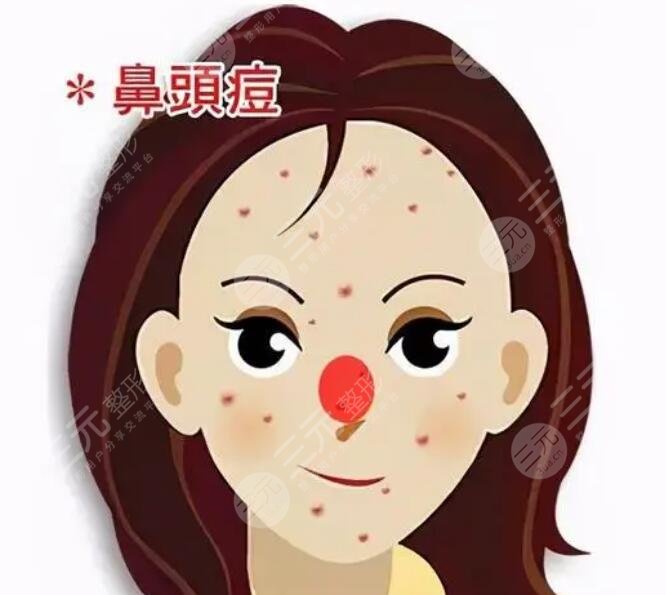 尋求醫(yī)美緩解：適用于嚴(yán)重痤瘡病例