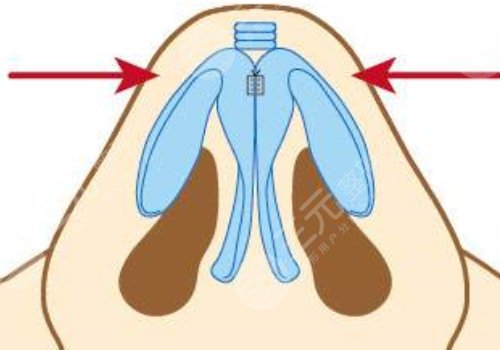 李信鋒醫(yī)生擅長(zhǎng)項(xiàng)目