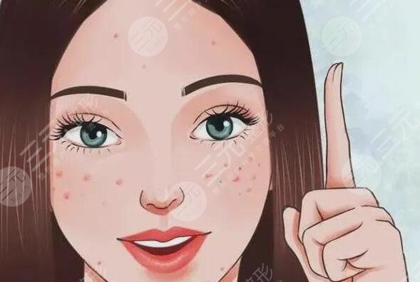 緩解青春痘費用大概多少錢？哪些方法有效且安全可靠？