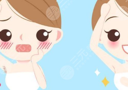 激光脫毛和冰點(diǎn)脫毛有什么區(qū)別？