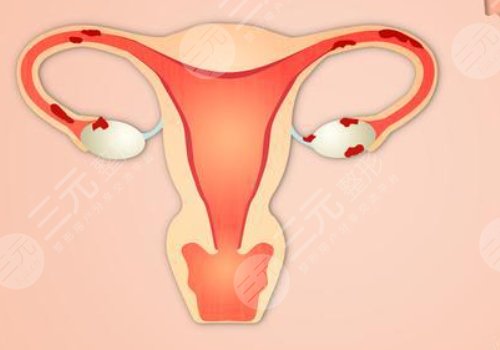 女性私處修復手術大概多少錢？