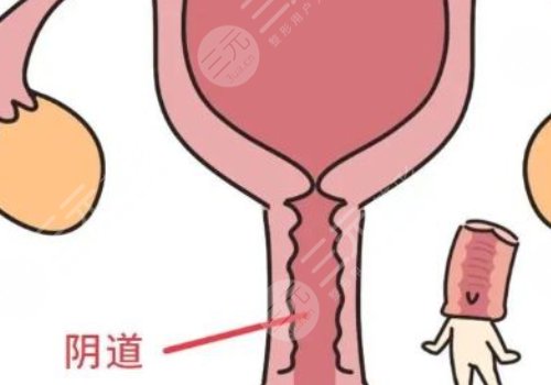 女性私處修復手術大概多少錢？