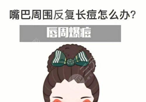 口周一直長痘痘什么原因？